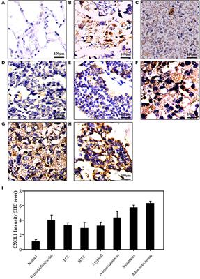 CXCL1 as an Unfavorable Prognosis Factor Negatively Regulated by DACH1 in Non-small Cell Lung Cancer